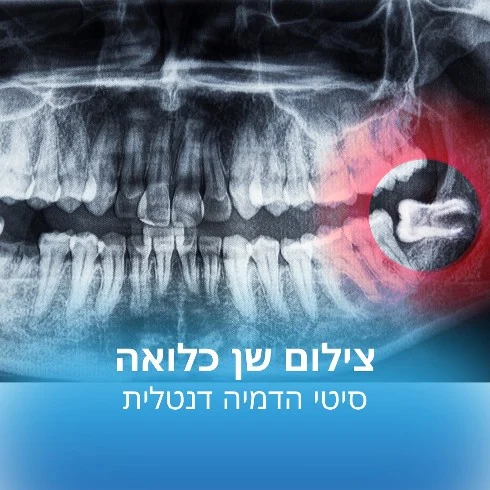 צילום שן כלואה